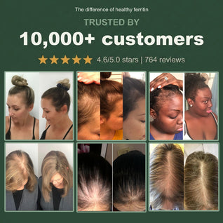 Gentle Iron + Vitamin C - Highly Absorbable Premium Chelated Iron with Organic Whole Foods